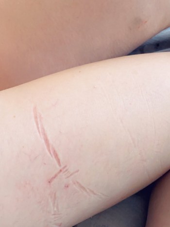 Belle Delphine Photos OnlyFans with Barbed Wire · Foto 2